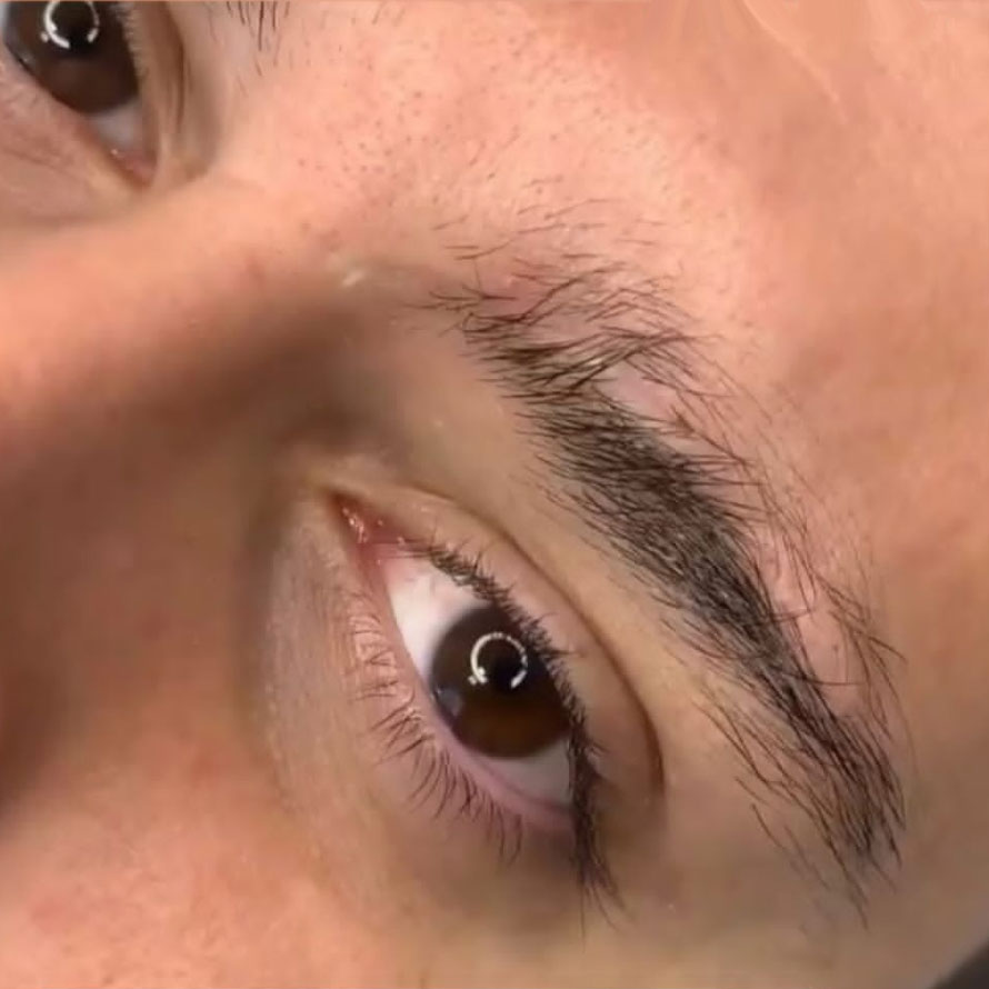 Does psoriasis cause problems with eyebrow microblading ?