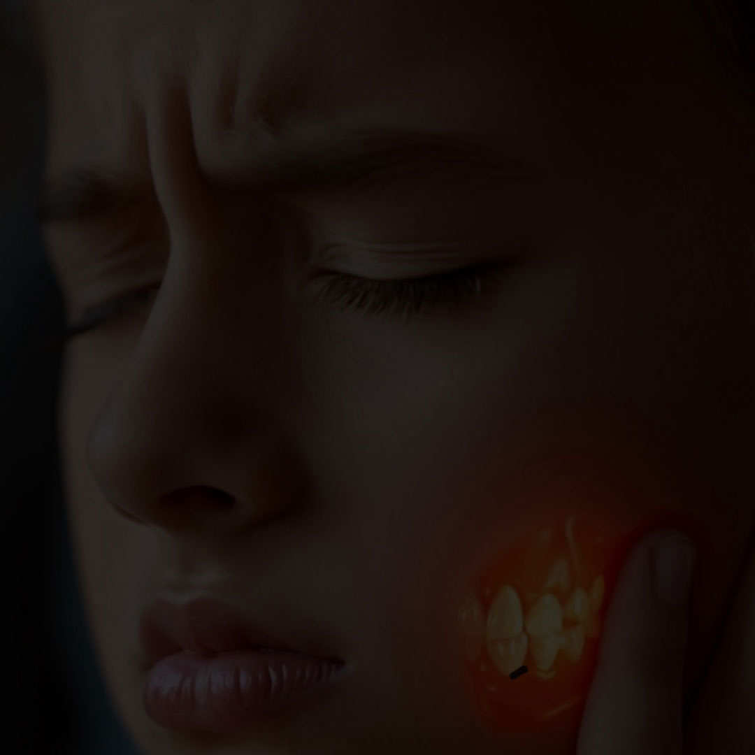 How to burst a tooth abscess at home + How to burst a tooth abscess