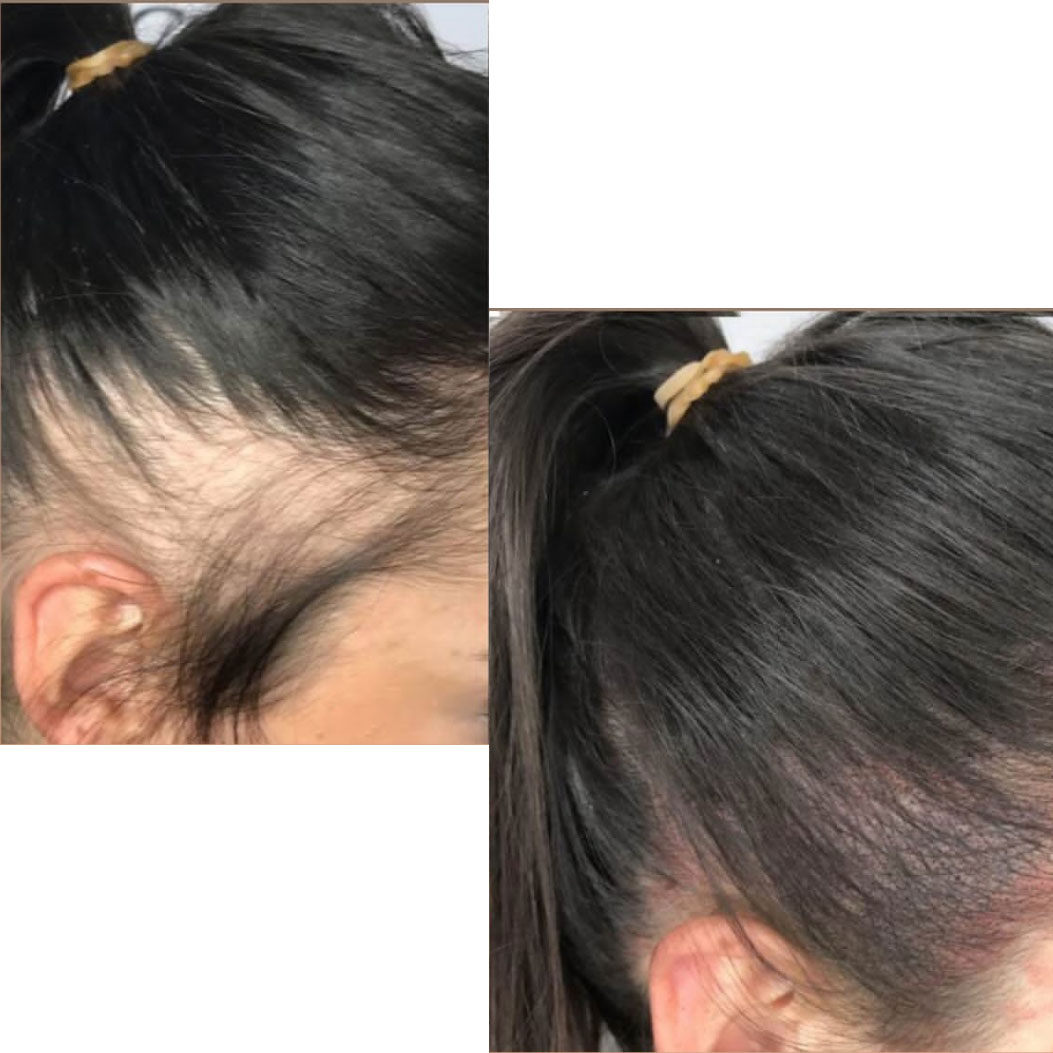 Temple microblading girlish