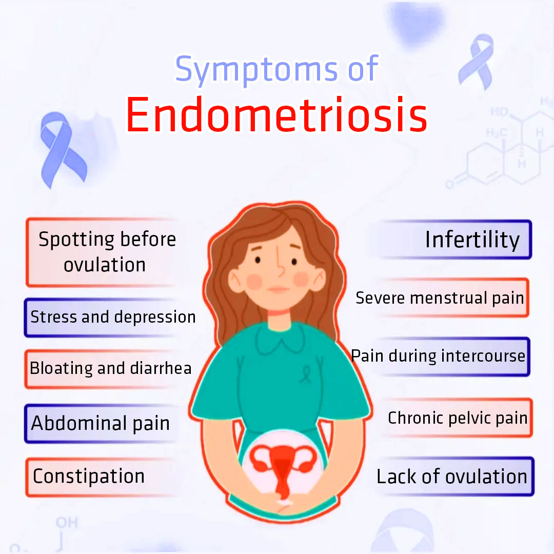 What is Symptoms of Endometriosis ?