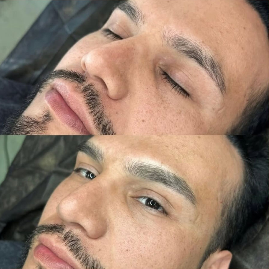 What is eyebrow microblading?