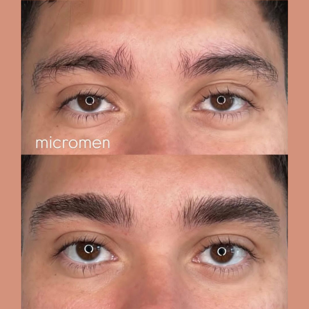 What is the difference between eyebrow thickening microblading and phibrowsis ?
